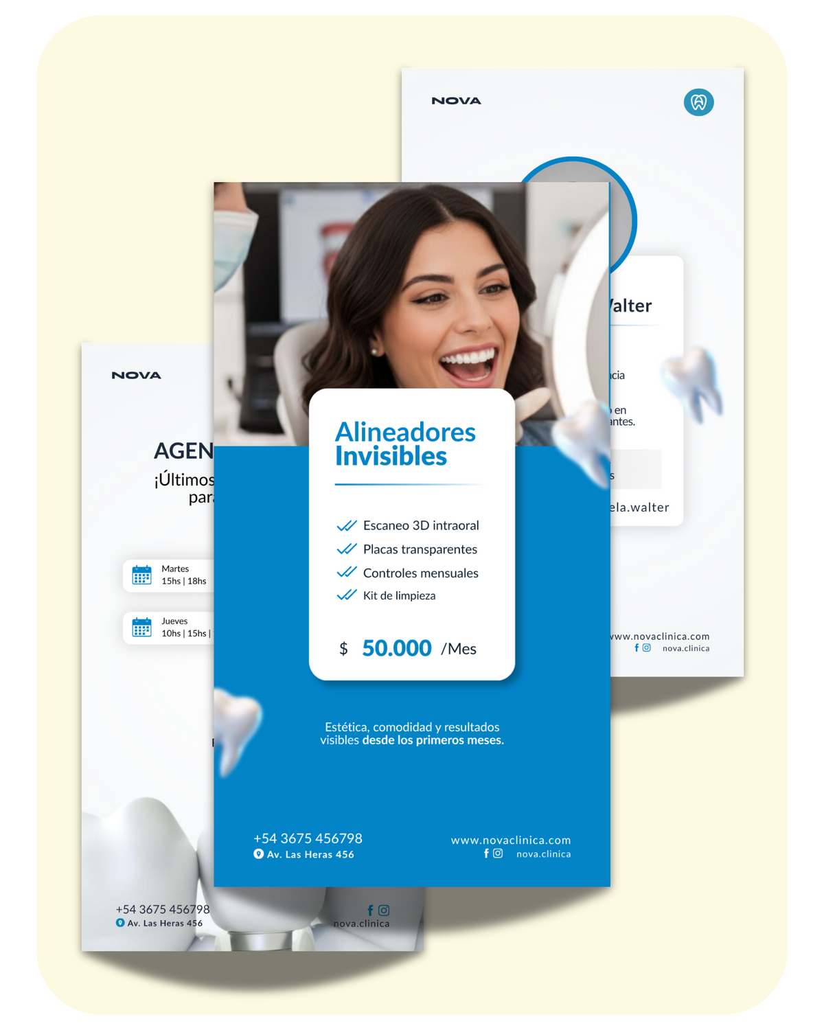 Pack Odontológico +80 Plantillas Editables en Canva