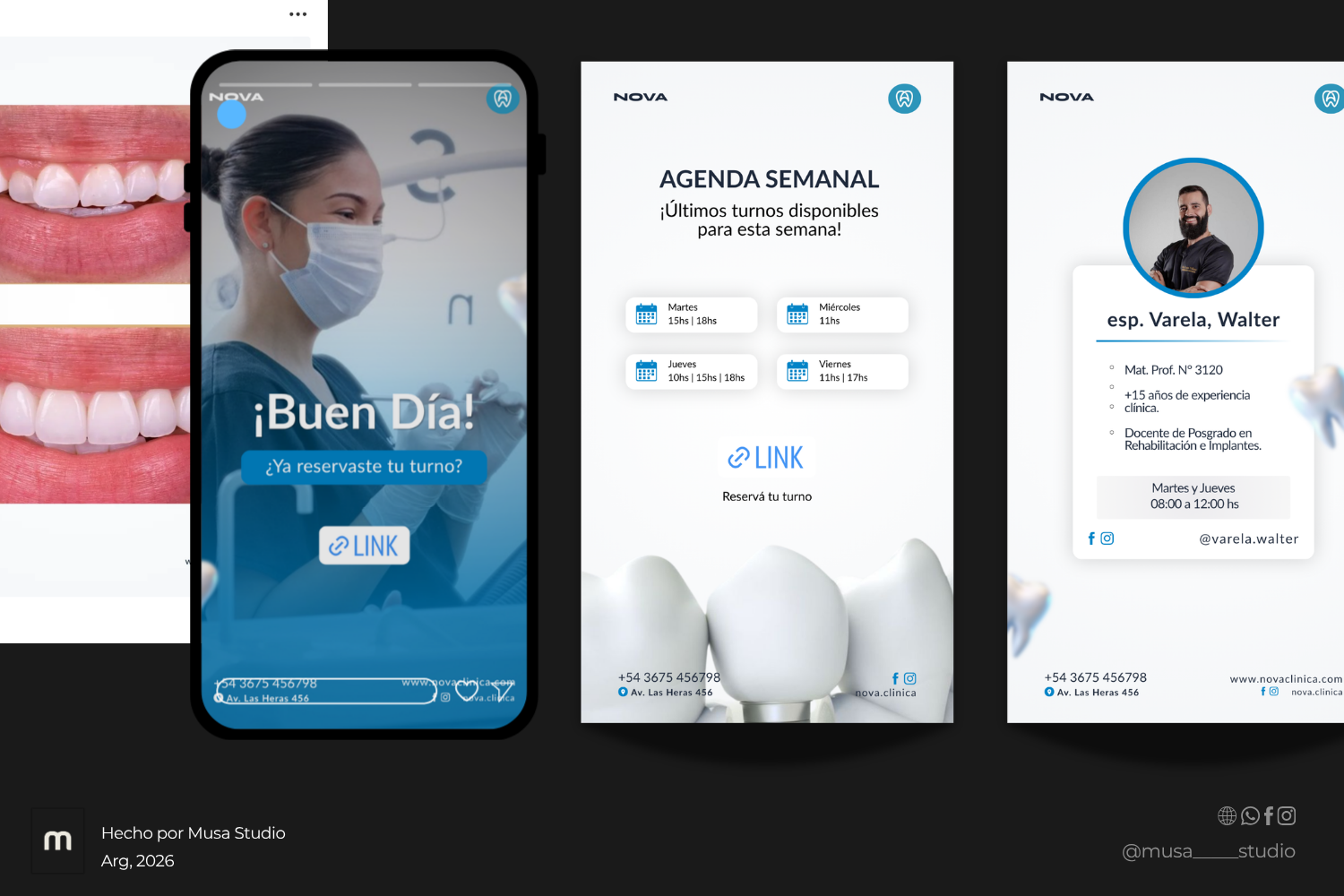 Pack Odontológico +70 Plantillas Editables en Canva